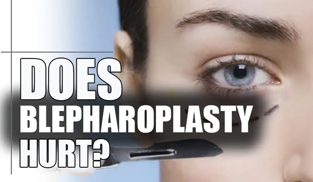 Having a Blepharoplasty surgery is a unique experience, but many factors can define whether you feel any pain during the surgery or not