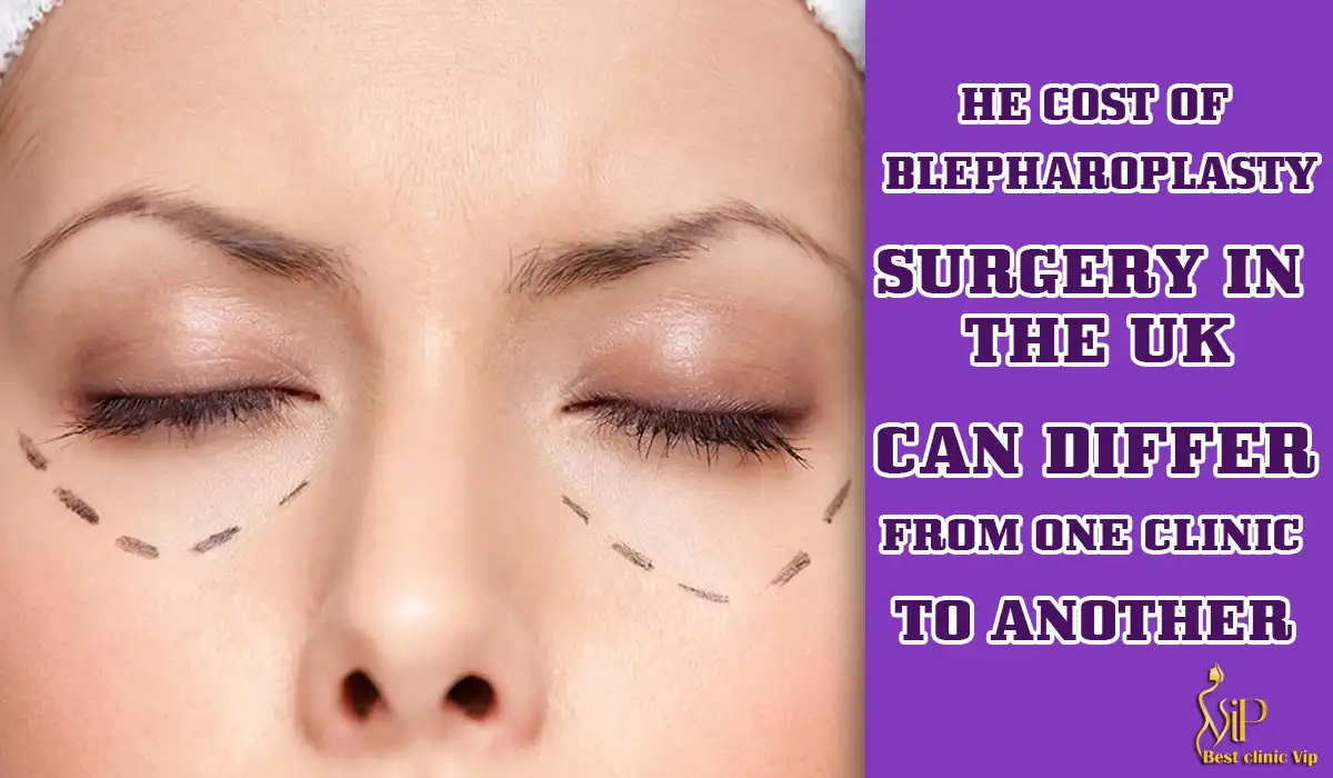 The cost of Blepharoplasty surgery in the UK can differ from one clinic to another