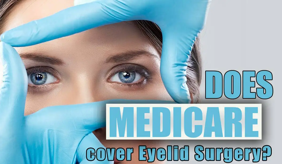 Medicare can cover eyelid surgery