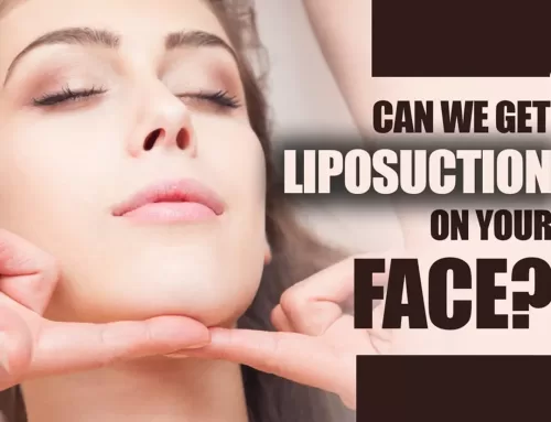 Can we get liposuction on your face?