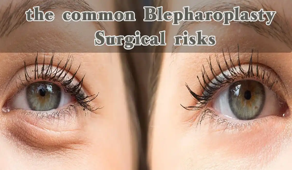 the common Blepharoplasty Surgical risks