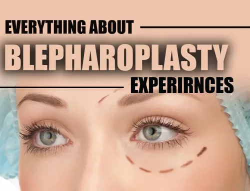 Blepharoplasty Experience (Blepharoplasty Questions & Answers)