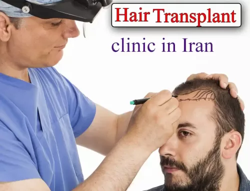 The best hair transplant clinic in Iran
