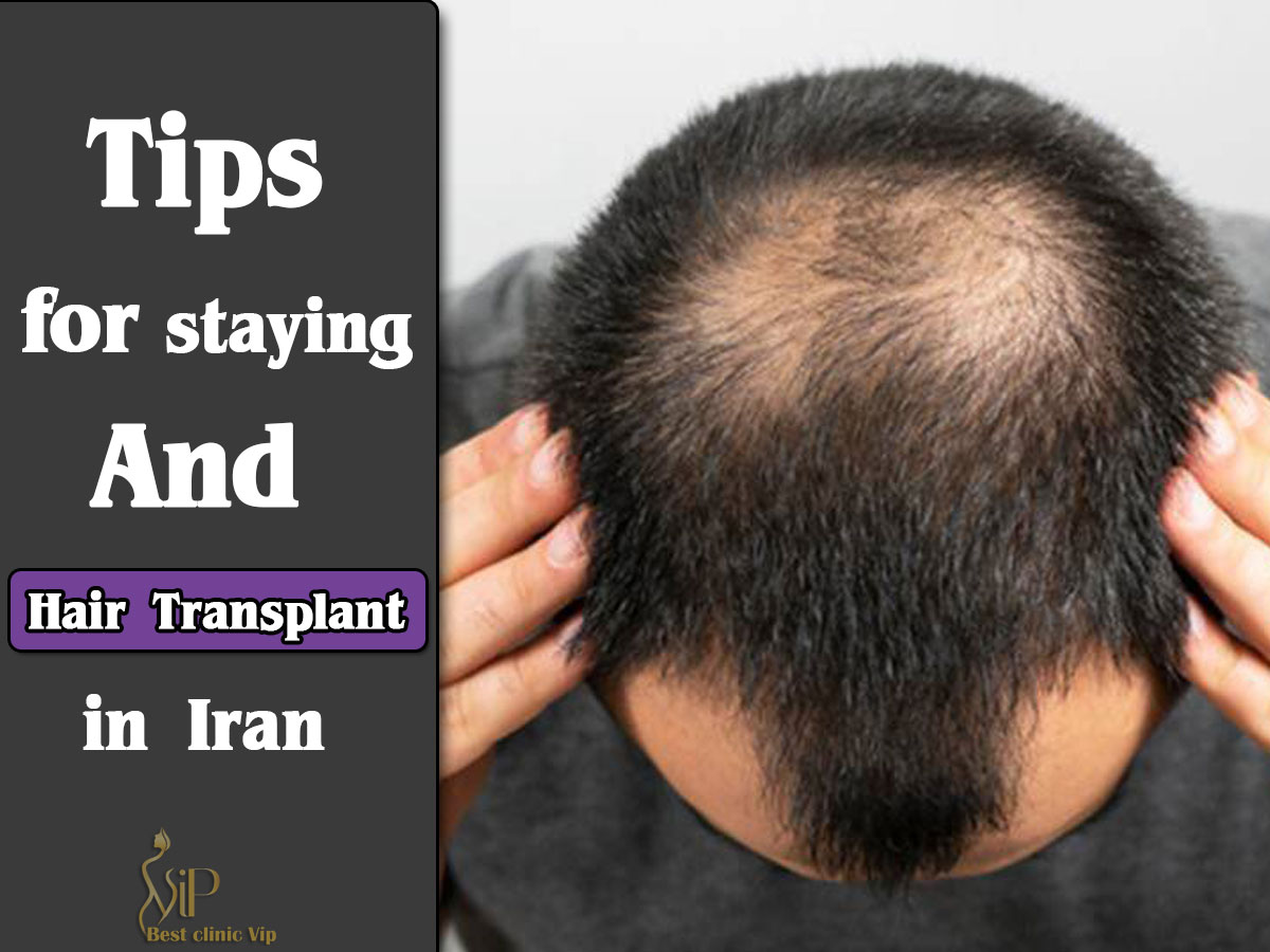 Tips for staying and hair transplant in Iran