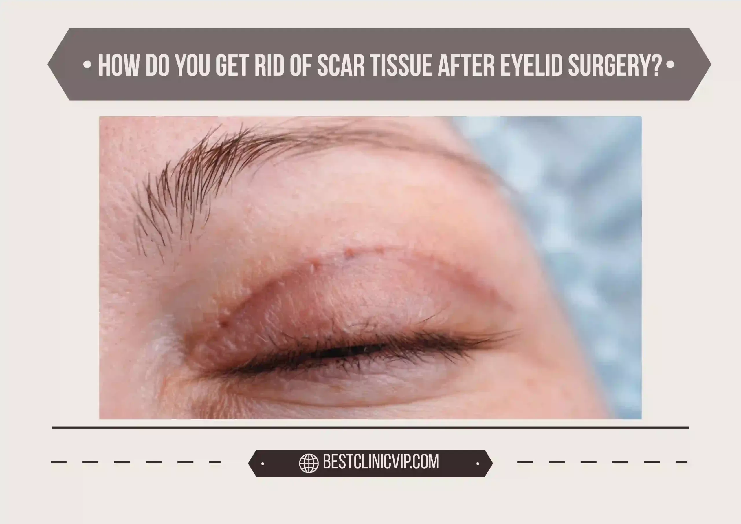 How do you get rid of scar tissue after eyelid surgery?