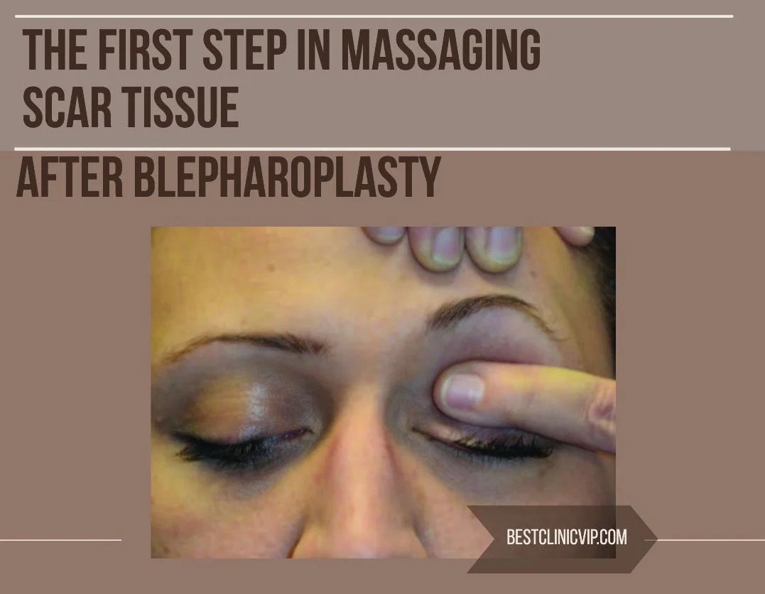 The first step in massaging scar tissue after blepharoplasty
