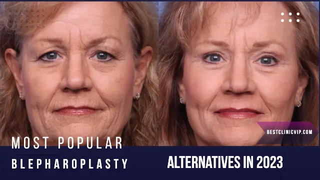 most popular Blepharoplasty Alternatives in 2023