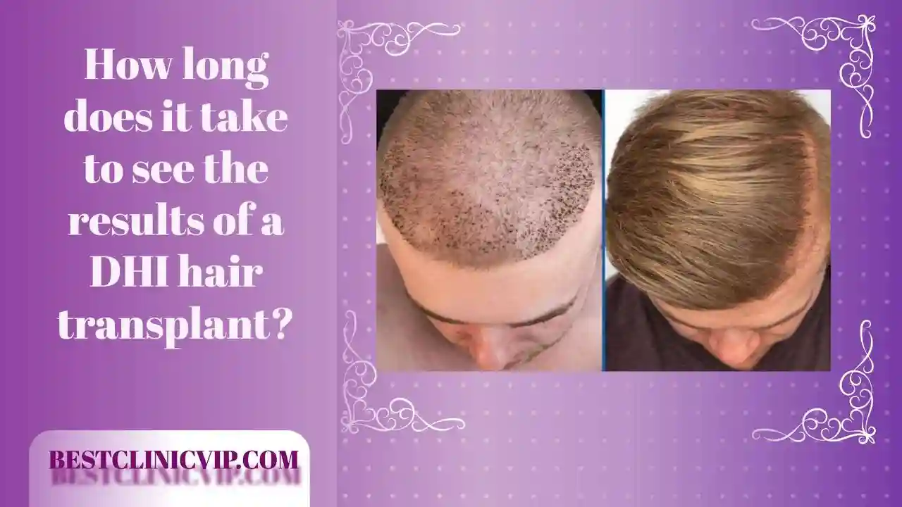 How long does it take to see the results of a DHI hair transplant?