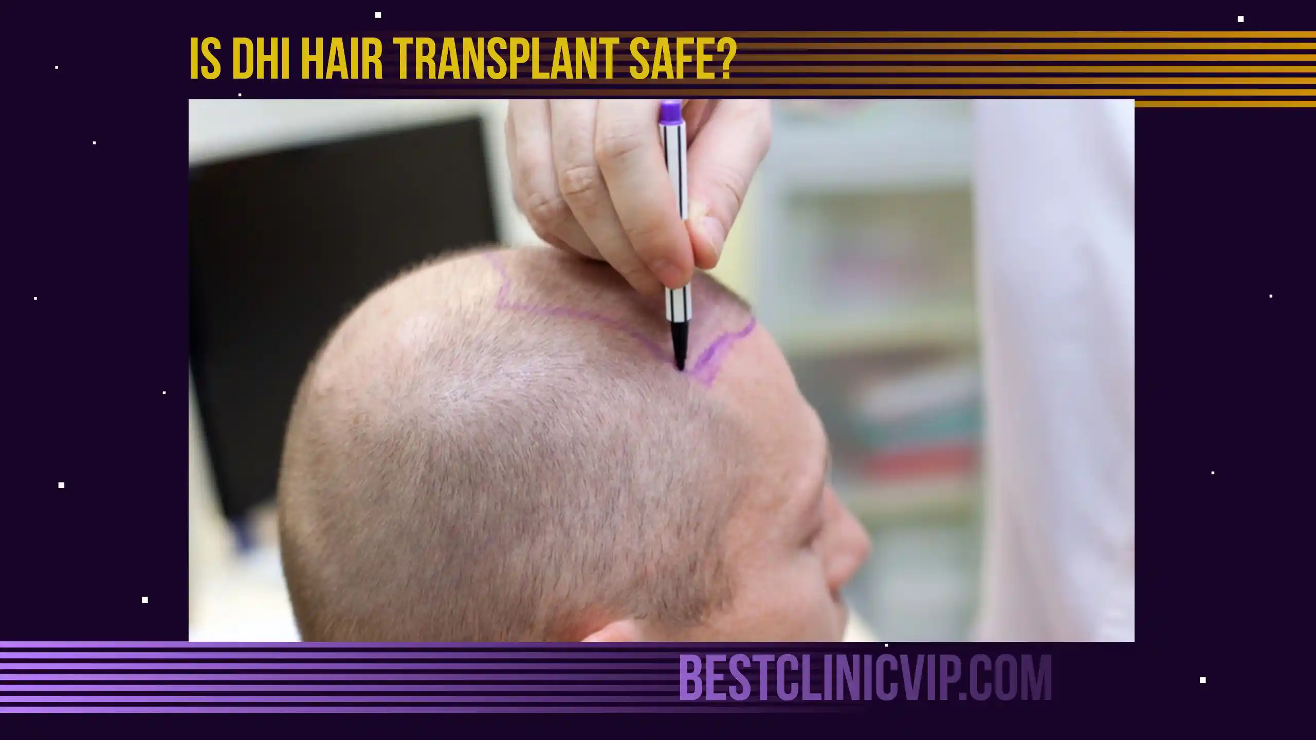 Is DHI hair transplant safe