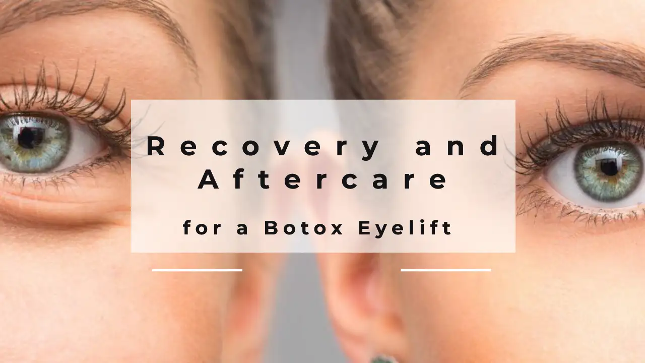 Recovery and Aftercare for a Botox Eyelift