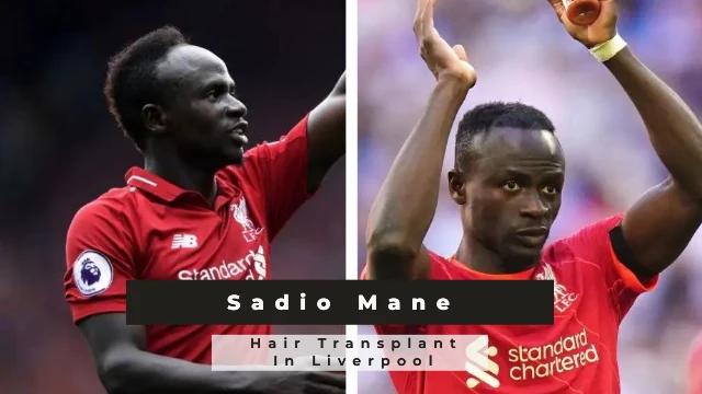 Sadio Mane Hair Transplant In Liverpool