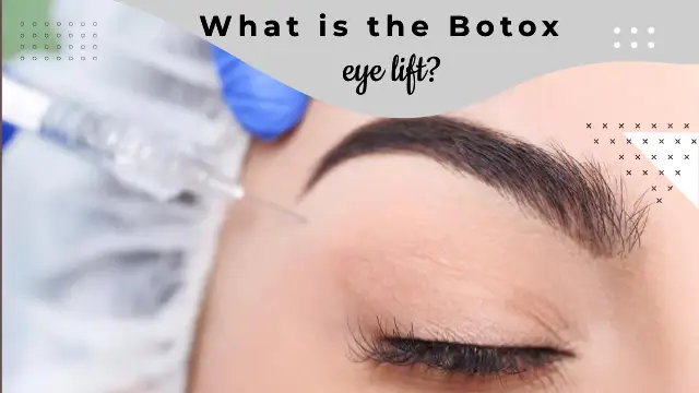 What is the Botox eye lift?