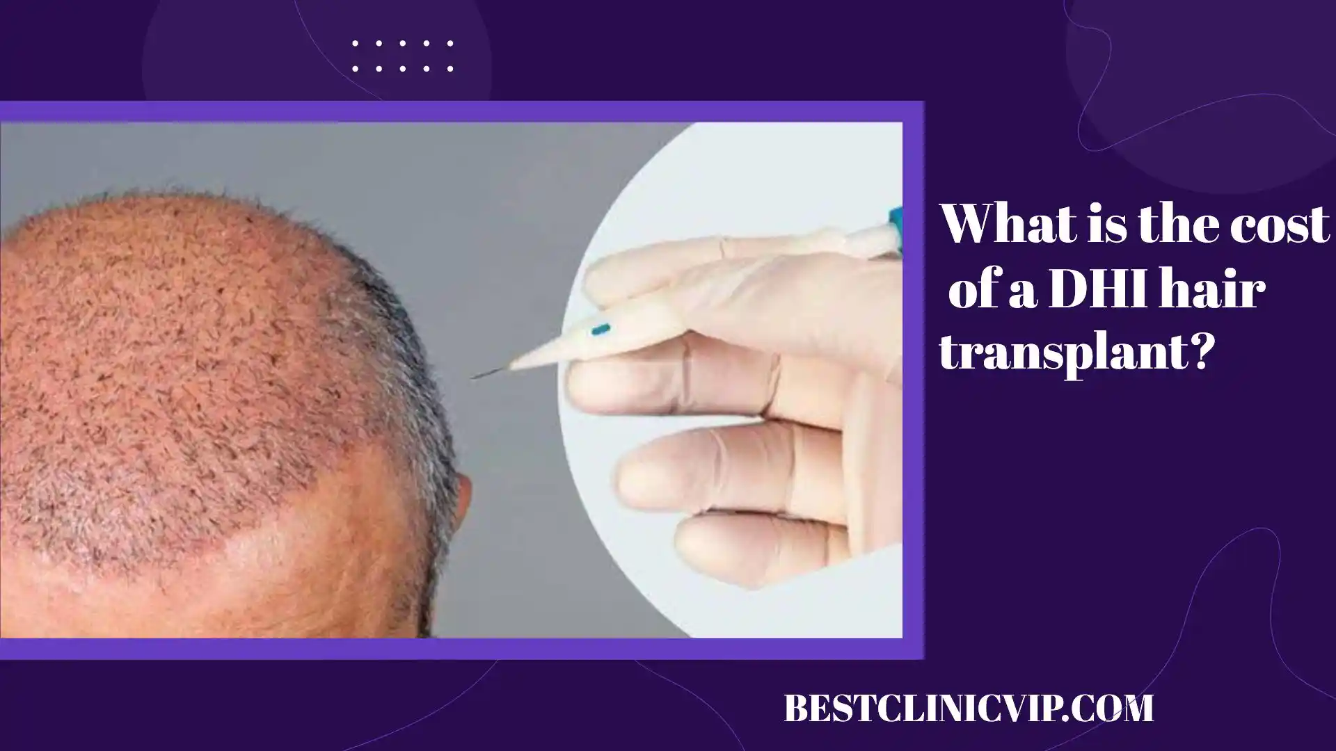 What is the cost of a DHI hair transplant?