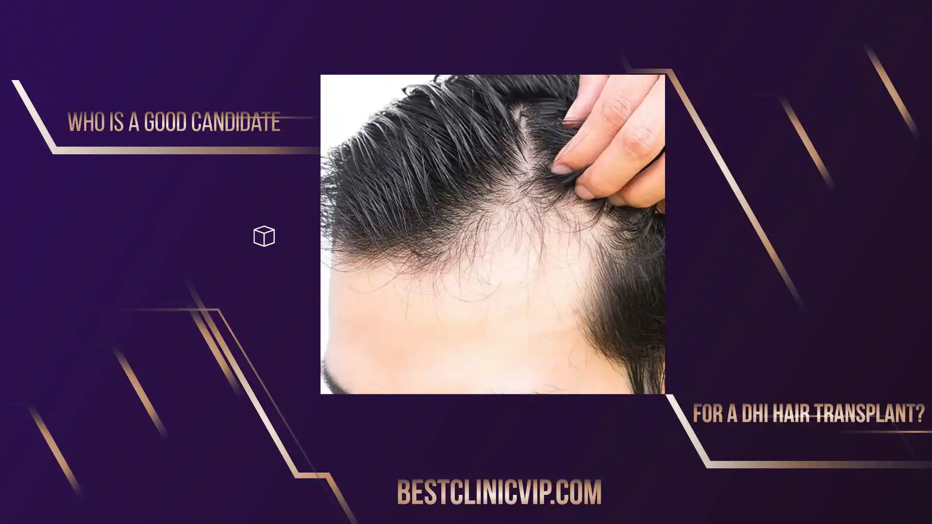 Who is a good candidate for a DHI hair transplant?