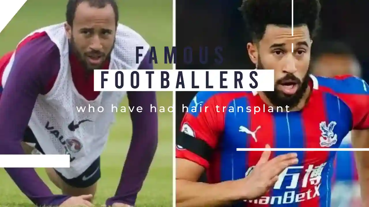 famous footballers who have had hair transplant
