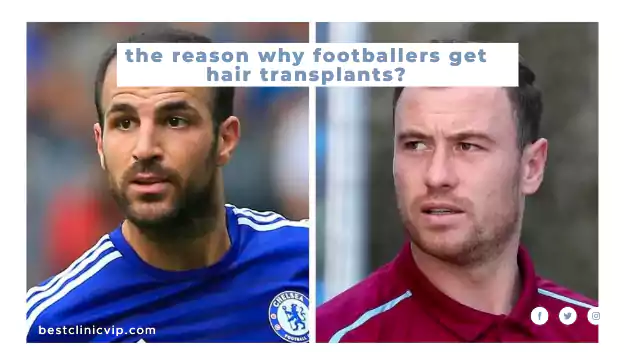the reason why footballers get hair transplants?
