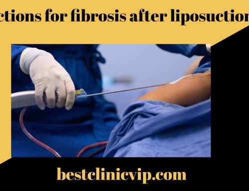 injections for fibrosis after liposuction