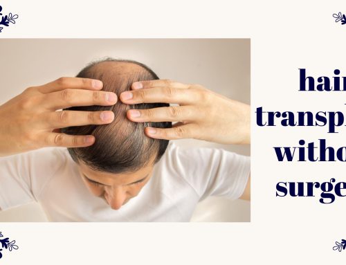 hair transplant without surgery