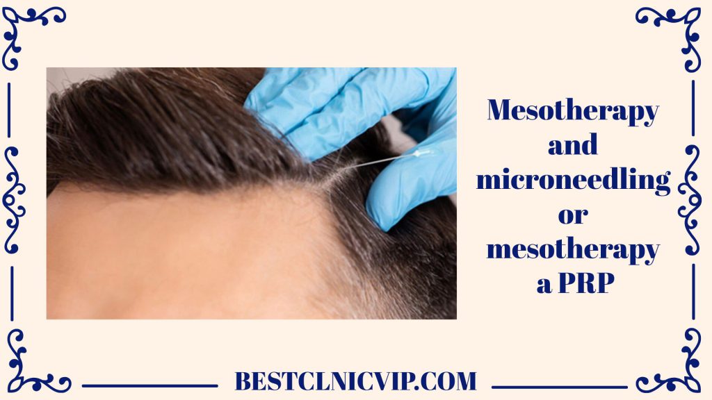 Reviving Locks: Mesotherapy, Microneedling & PRP for Hair