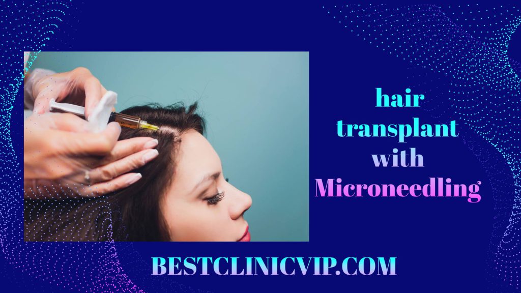 Micro-Needling: Optimizing Hair Transplant Success