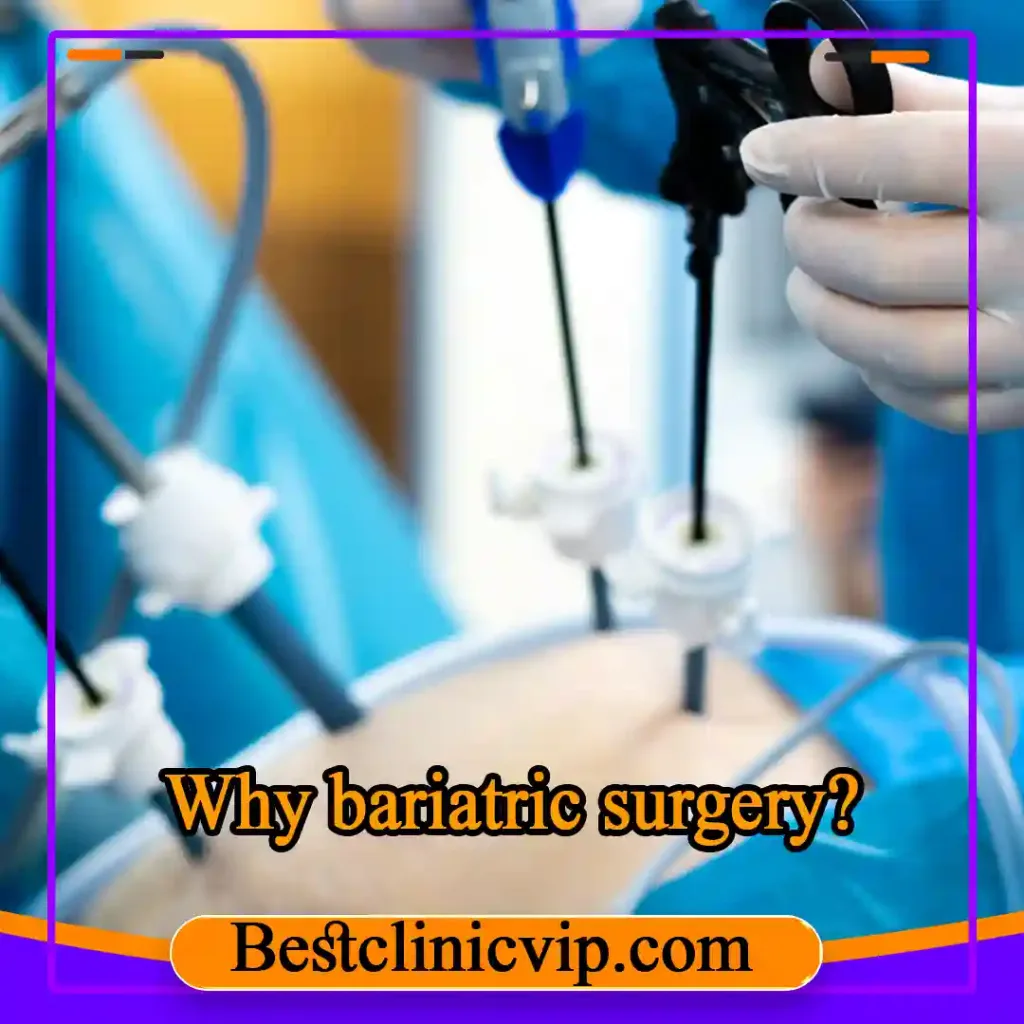 Why bariatric surgery?