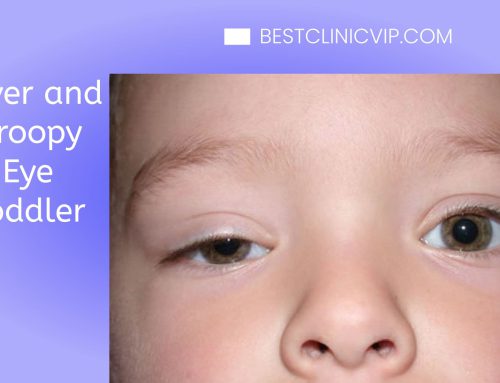 Fever and Droopy Eye Toddler